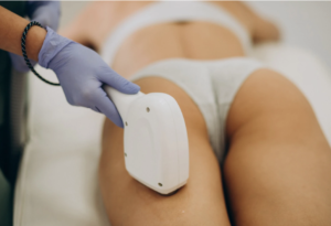 Epilation laser de l'arrière des cuisses à l'Eveil d'Essences