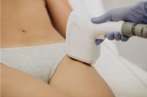 Epilation laser bikini intégral à l'Eveil d'Essences