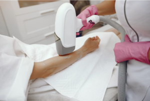 Epilation laser des bras à l'Eveil d'Essences